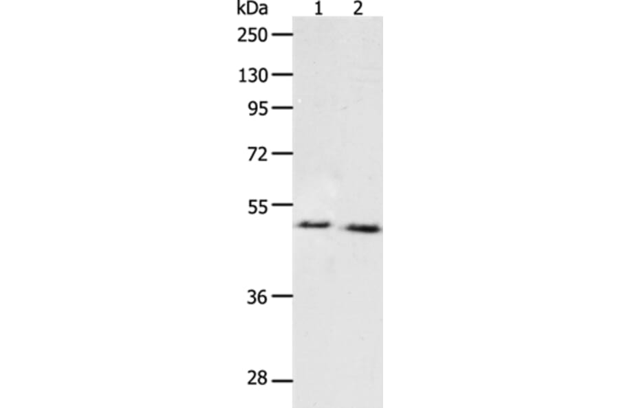 PPARA Antibody from Signalway Antibody (37219) - Antibodies.com