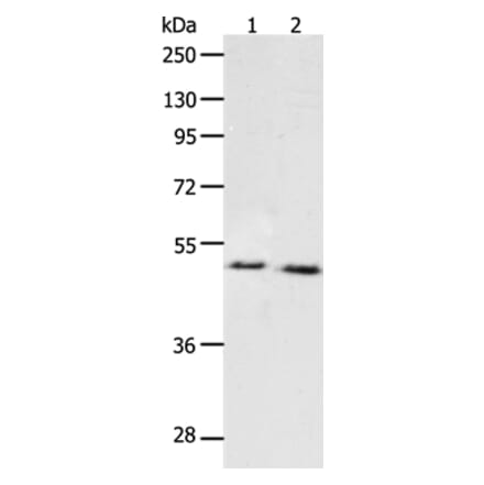 PPARA Antibody from Signalway Antibody (37219) - Antibodies.com
