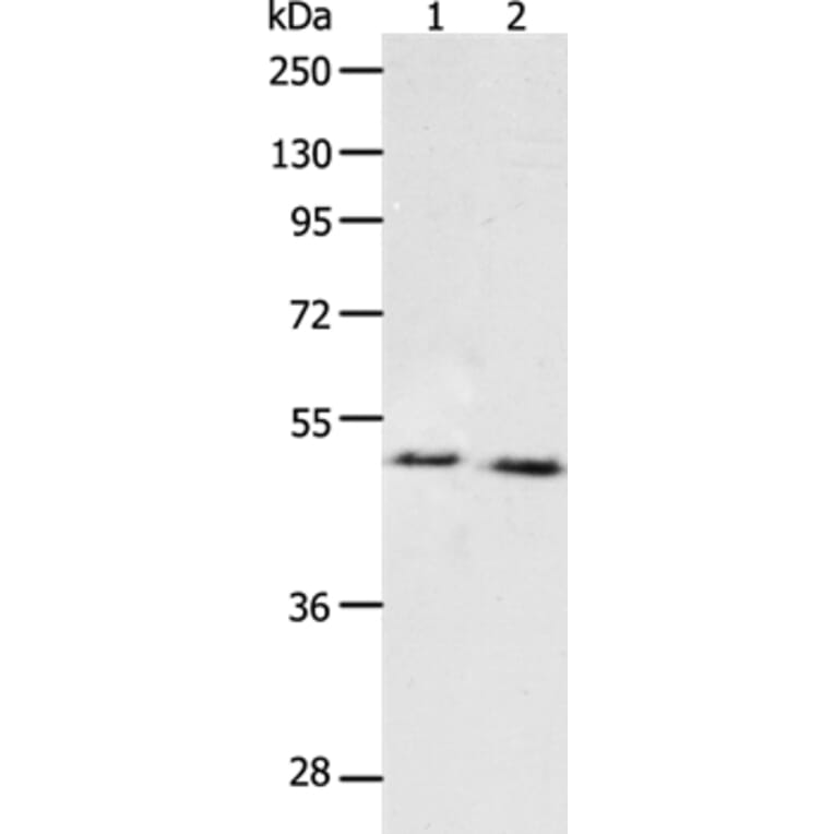 PPARA Antibody from Signalway Antibody (37219) - Antibodies.com