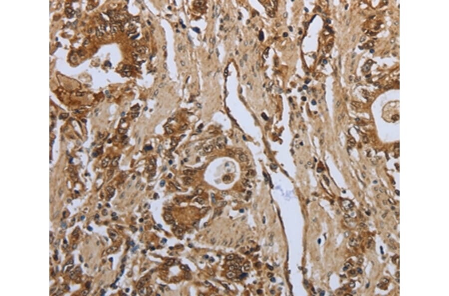Immunohistochemistry - PPARA Antibody from Signalway Antibody (37219) - Antibodies.com
