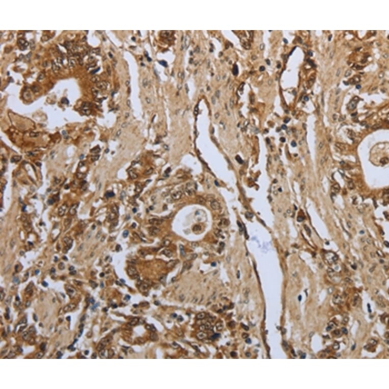 Immunohistochemistry - PPARA Antibody from Signalway Antibody (37219) - Antibodies.com