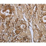 Immunohistochemistry - PPARA Antibody from Signalway Antibody (37219) - Antibodies.com