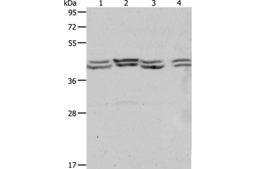 PSMD6 Antibody from Signalway Antibody (37223) - Antibodies.com