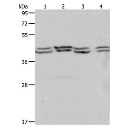 PSMD6 Antibody from Signalway Antibody (37223) - Antibodies.com