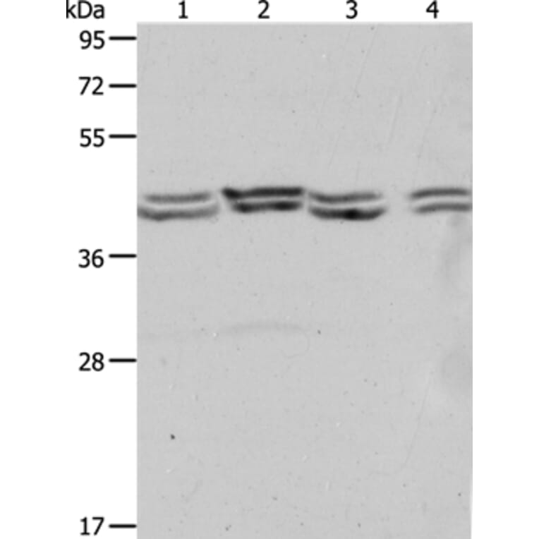 PSMD6 Antibody from Signalway Antibody (37223) - Antibodies.com