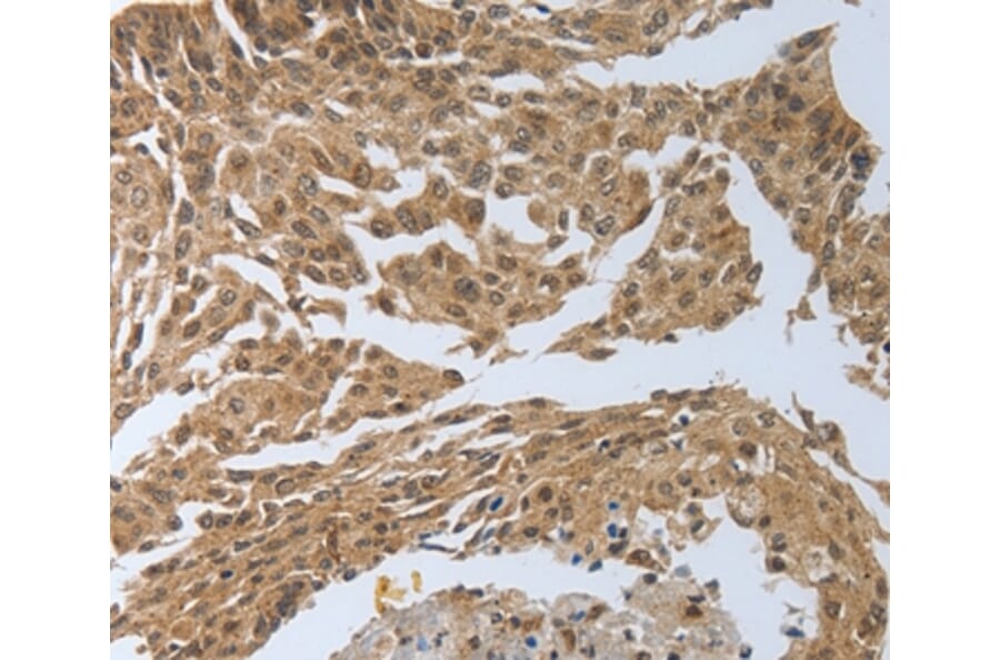 Immunohistochemistry - PSMD6 Antibody from Signalway Antibody (37223) - Antibodies.com