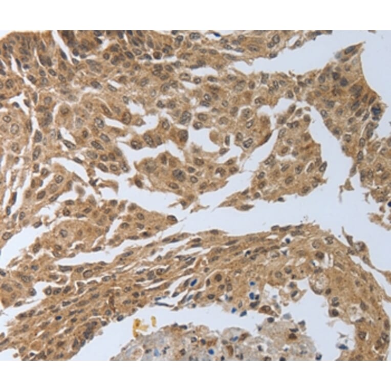 Immunohistochemistry - PSMD6 Antibody from Signalway Antibody (37223) - Antibodies.com