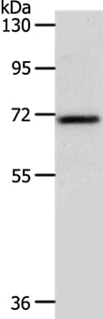 Gel: 10% SDS-PAGE Lysates (from left to right): Mouse liver tissue Amount of lysate: 40ug per lane Primary antibody: 1/800 dilution Secondary antibody dilution: 1/8000 Exposure time: 1 minute