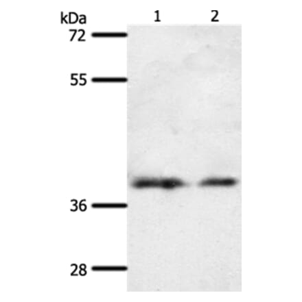 SSTR1 Antibody from Signalway Antibody (37256) - Antibodies.com