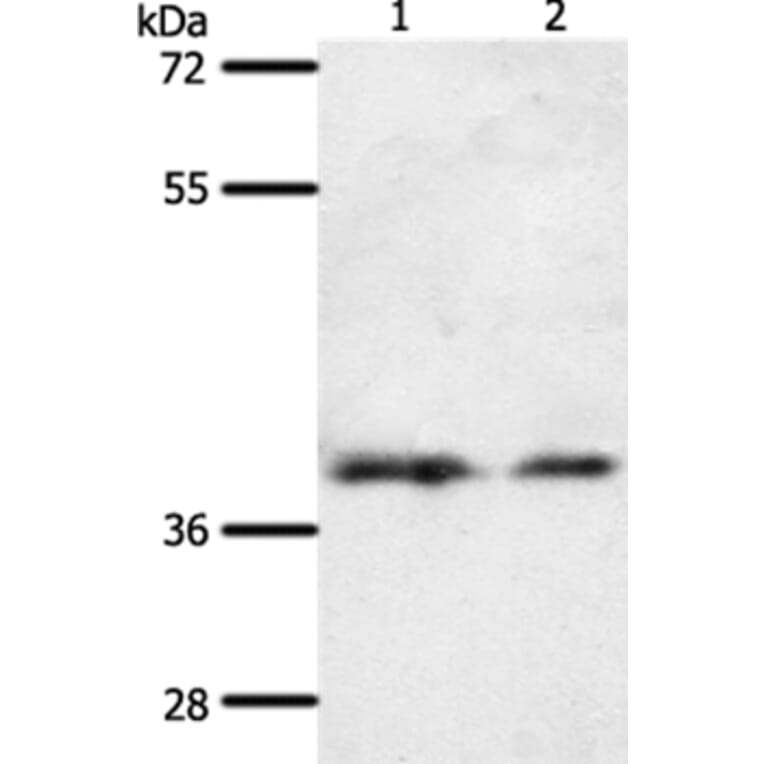 SSTR1 Antibody from Signalway Antibody (37256) - Antibodies.com