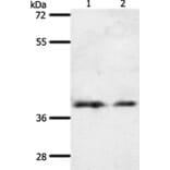 SSTR1 Antibody from Signalway Antibody (37256) - Antibodies.com