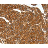 Immunohistochemistry - SSTR1 Antibody from Signalway Antibody (37256) - Antibodies.com