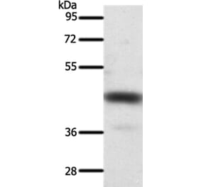 SSTR2 Antibody from Signalway Antibody (37257) - Antibodies.com