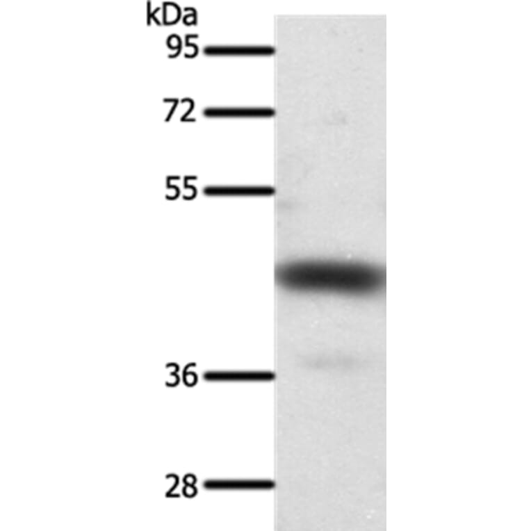 SSTR2 Antibody from Signalway Antibody (37257) - Antibodies.com