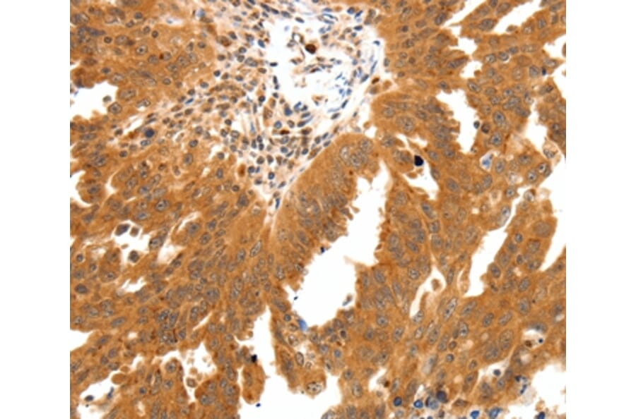 Immunohistochemistry - SSTR2 Antibody from Signalway Antibody (37257) - Antibodies.com