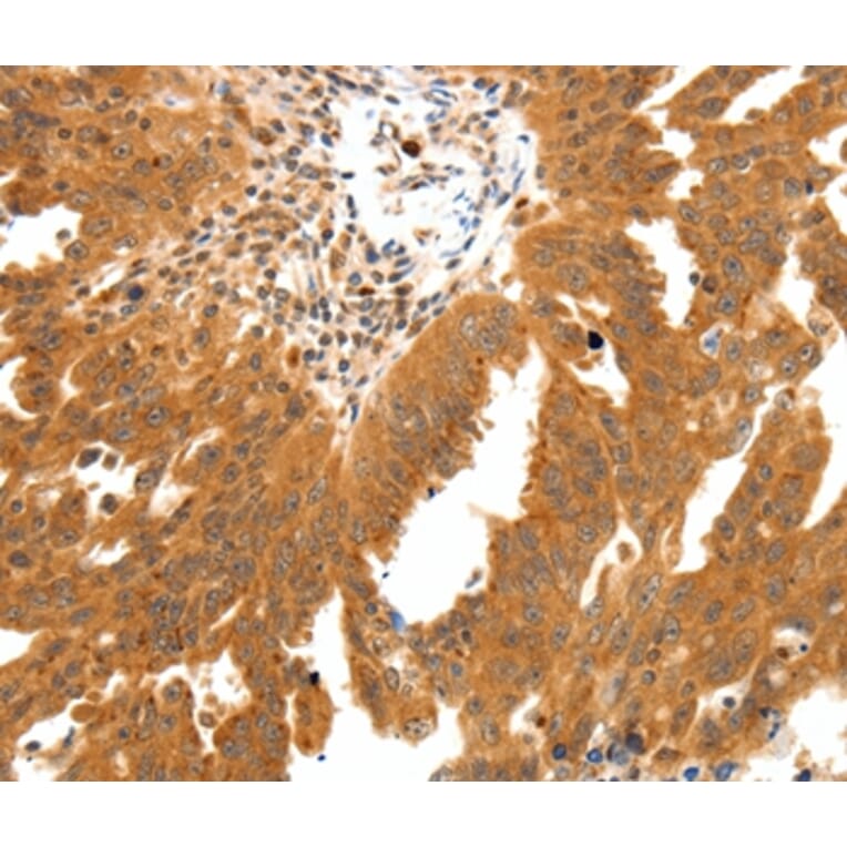 Immunohistochemistry - SSTR2 Antibody from Signalway Antibody (37257) - Antibodies.com