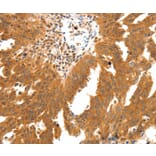 Immunohistochemistry - SSTR2 Antibody from Signalway Antibody (37257) - Antibodies.com