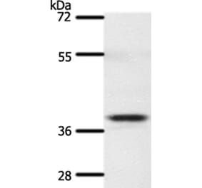 SSTR5 Antibody from Signalway Antibody (37260) - Antibodies.com