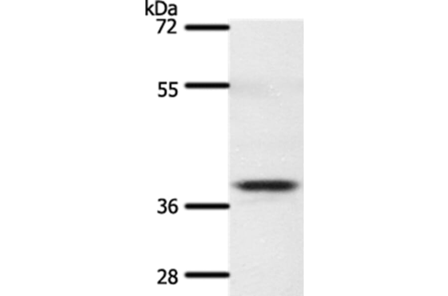 SSTR5 Antibody from Signalway Antibody (37260) - Antibodies.com