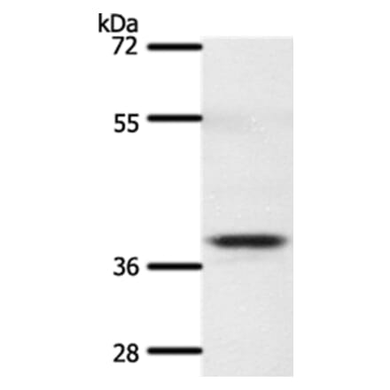 SSTR5 Antibody from Signalway Antibody (37260) - Antibodies.com