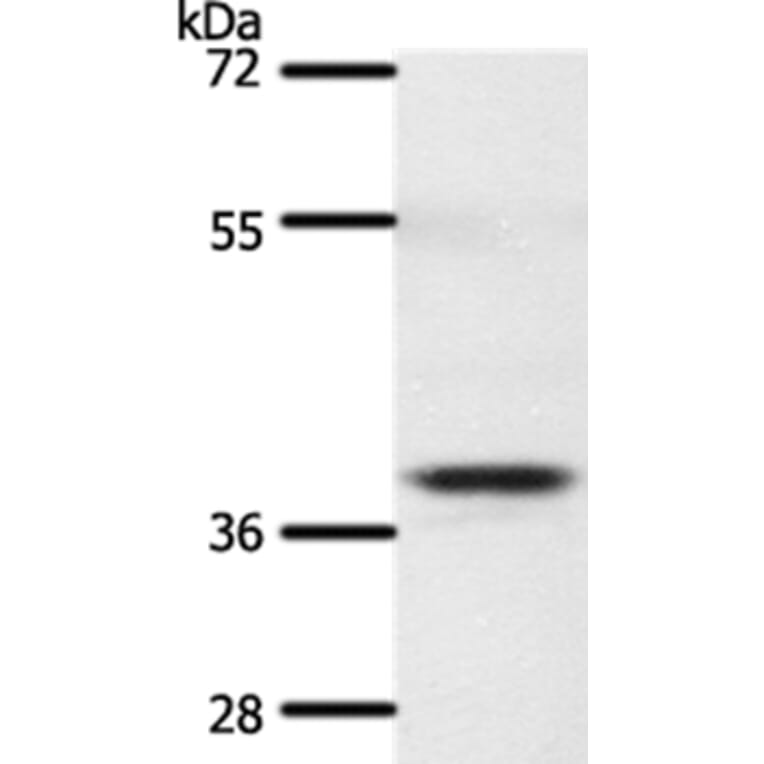 SSTR5 Antibody from Signalway Antibody (37260) - Antibodies.com