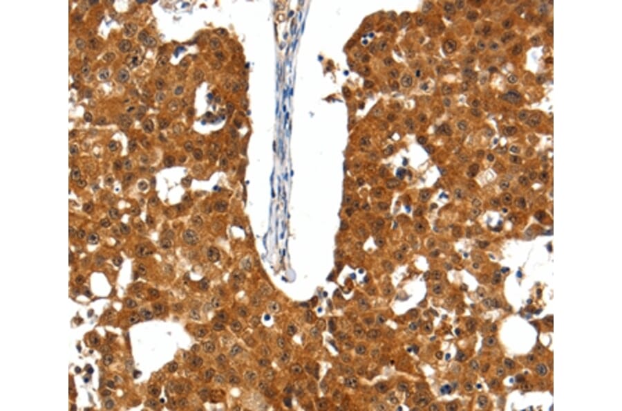 Immunohistochemistry - SSTR5 Antibody from Signalway Antibody (37260) - Antibodies.com