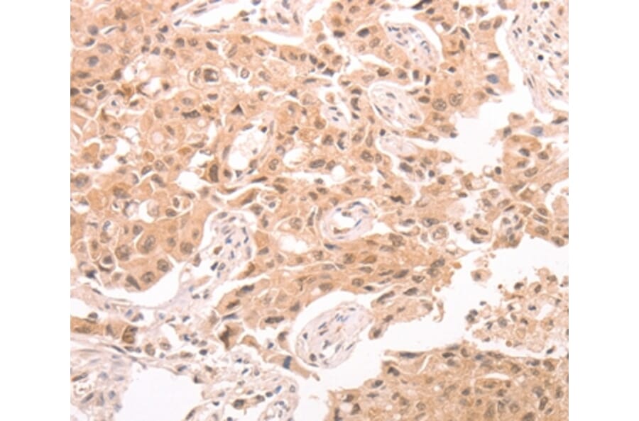 Immunohistochemistry - TRPC3 Antibody from Signalway Antibody (37283) - Antibodies.com