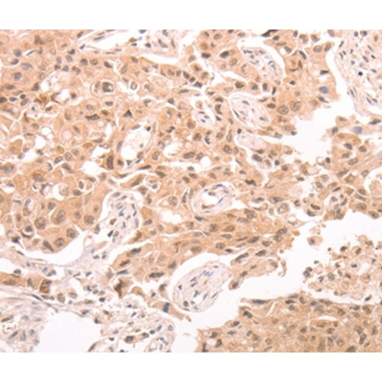 Immunohistochemistry - TRPC3 Antibody from Signalway Antibody (37283) - Antibodies.com