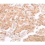 Immunohistochemistry - TRPC3 Antibody from Signalway Antibody (37283) - Antibodies.com