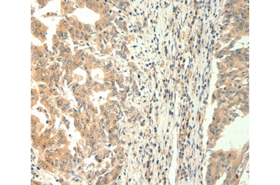 Immunohistochemistry - TRPM5 Antibody from Signalway Antibody (37284) - Antibodies.com