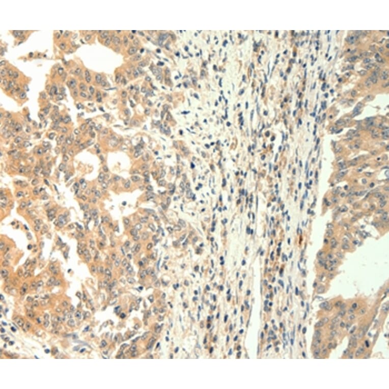 Immunohistochemistry - TRPM5 Antibody from Signalway Antibody (37284) - Antibodies.com