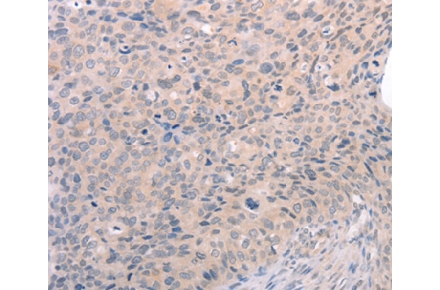 Immunohistochemistry - S1PR3 Antibody from Signalway Antibody (37289) - Antibodies.com