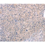 Immunohistochemistry - S1PR3 Antibody from Signalway Antibody (37289) - Antibodies.com
