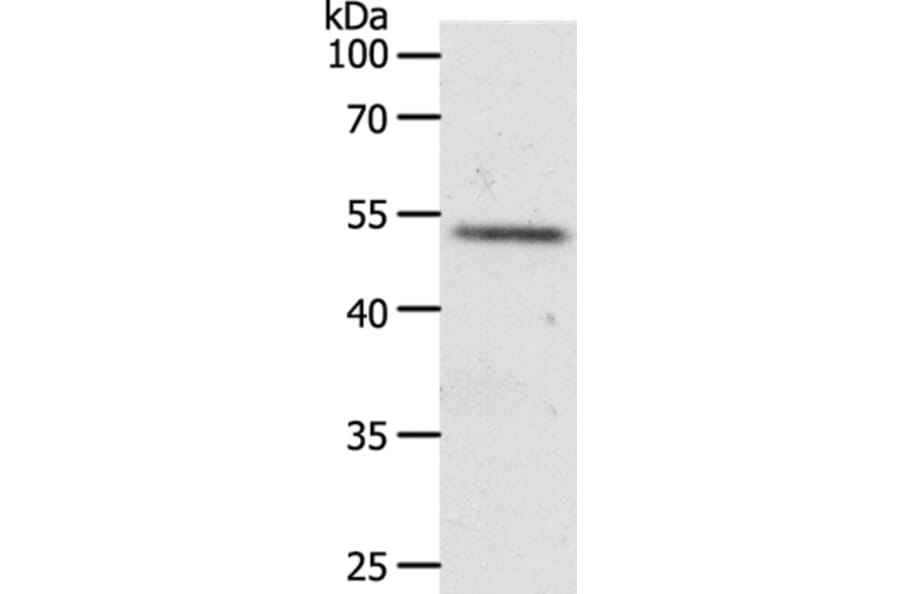 RXFP3 Antibody from Signalway Antibody (37299) - Antibodies.com