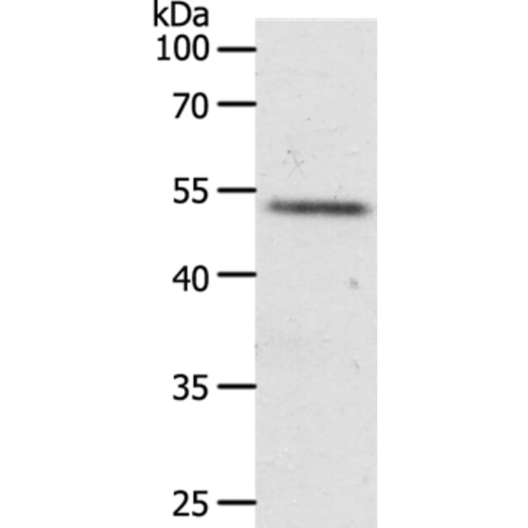 RXFP3 Antibody from Signalway Antibody (37299) - Antibodies.com