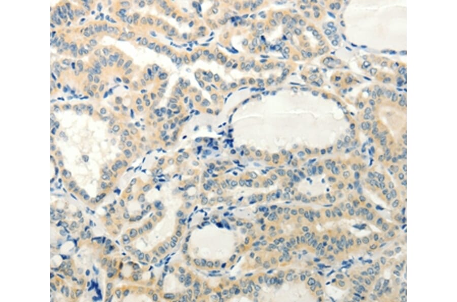 Immunohistochemistry - RXFP3 Antibody from Signalway Antibody (37299) - Antibodies.com