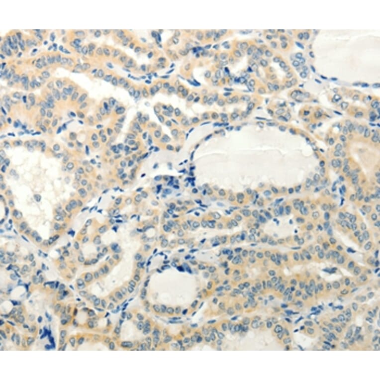 Immunohistochemistry - RXFP3 Antibody from Signalway Antibody (37299) - Antibodies.com