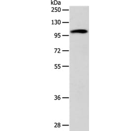 ADCY1 Antibody from Signalway Antibody (37317) - Antibodies.com