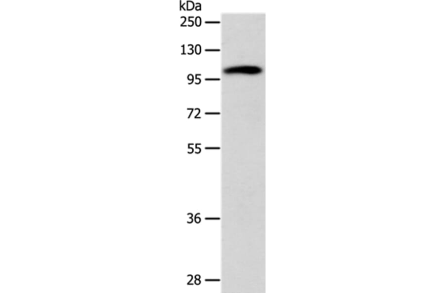 ADCY1 Antibody from Signalway Antibody (37317) - Antibodies.com