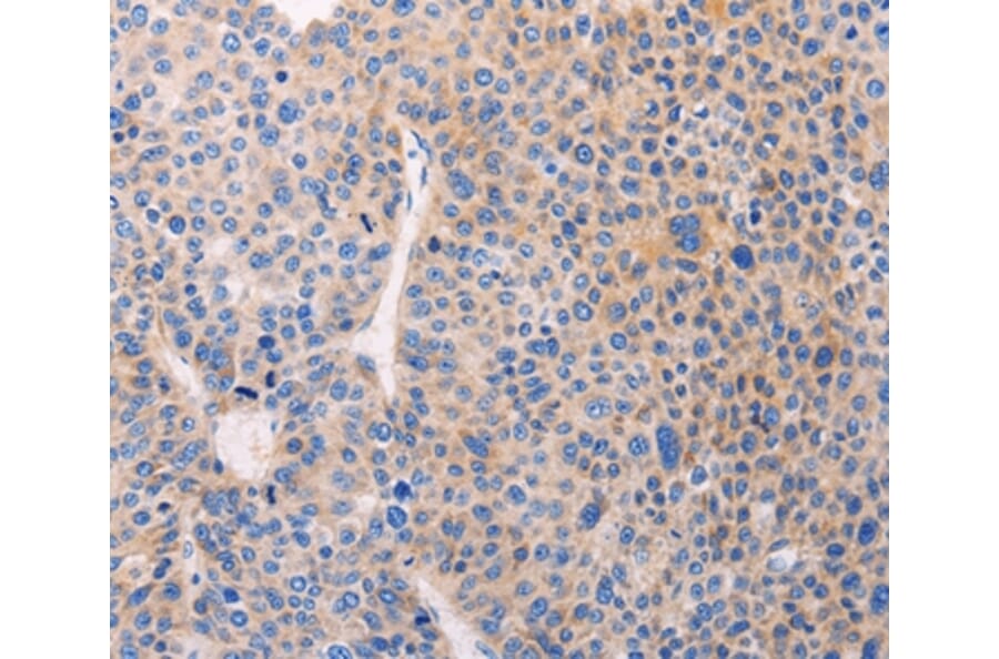 Immunohistochemistry - ADCY1 Antibody from Signalway Antibody (37317) - Antibodies.com