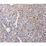 Immunohistochemistry - ADCY1 Antibody from Signalway Antibody (37317) - Antibodies.com