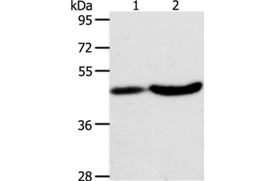 PLIN2 Antibody from Signalway Antibody (37318) - Antibodies.com