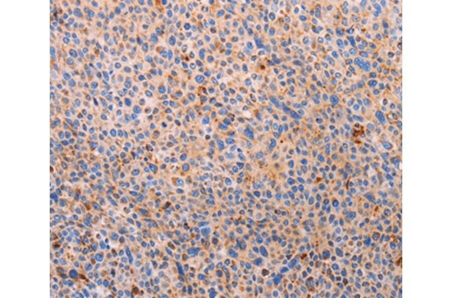 Immunohistochemistry - PLIN2 Antibody from Signalway Antibody (37318) - Antibodies.com