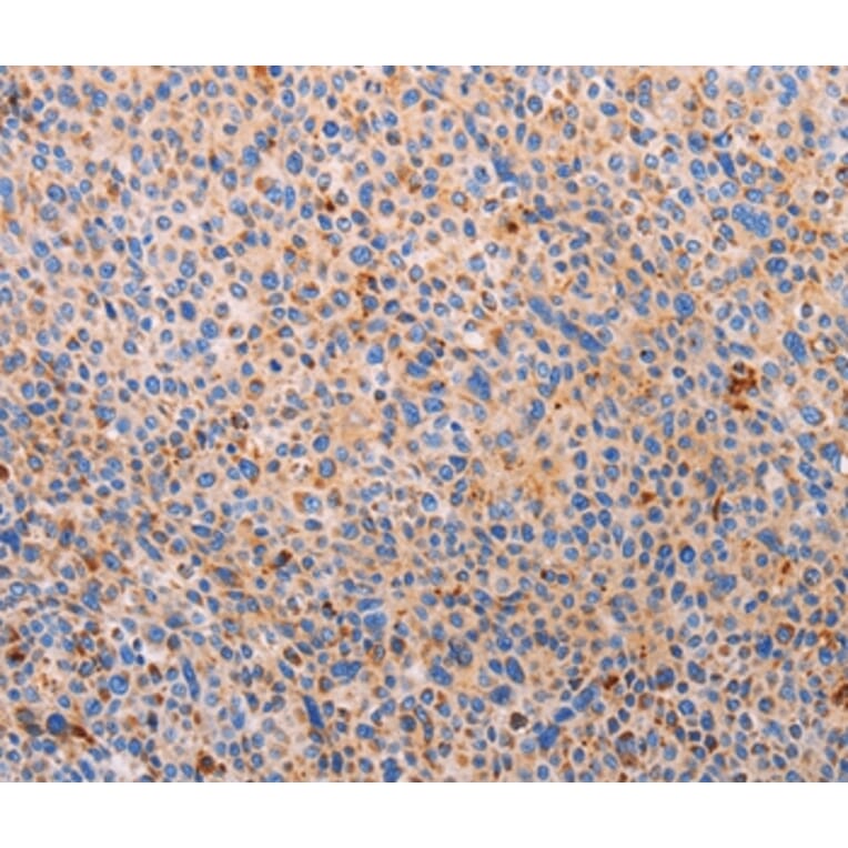 Immunohistochemistry - PLIN2 Antibody from Signalway Antibody (37318) - Antibodies.com