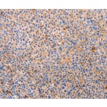 Immunohistochemistry - PLIN2 Antibody from Signalway Antibody (37318) - Antibodies.com