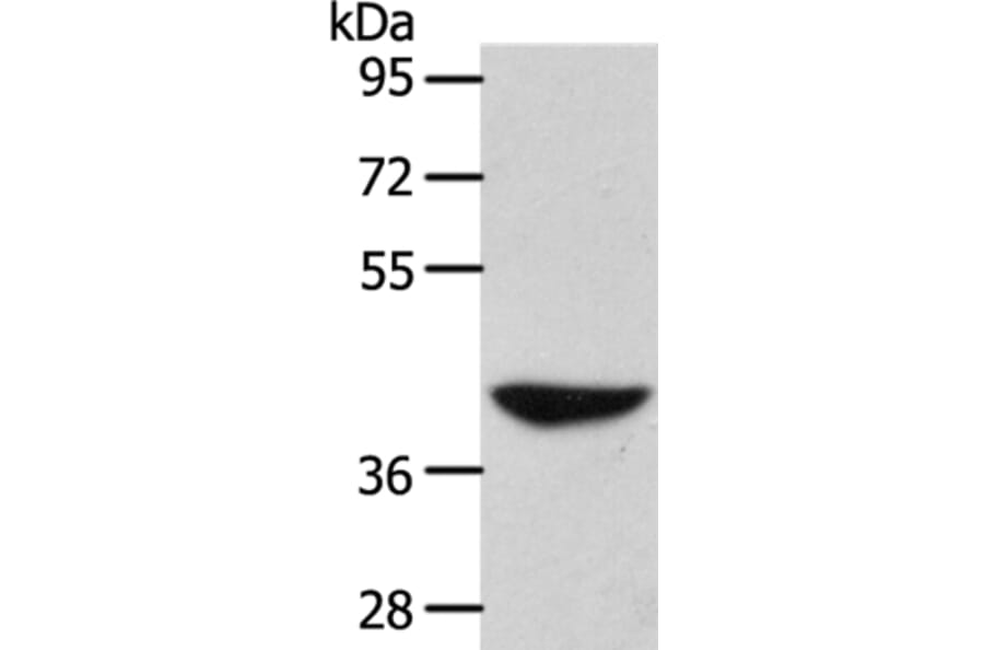ADH1B Antibody from Signalway Antibody (37319) - Antibodies.com
