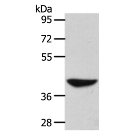 ADH1B Antibody from Signalway Antibody (37319) - Antibodies.com