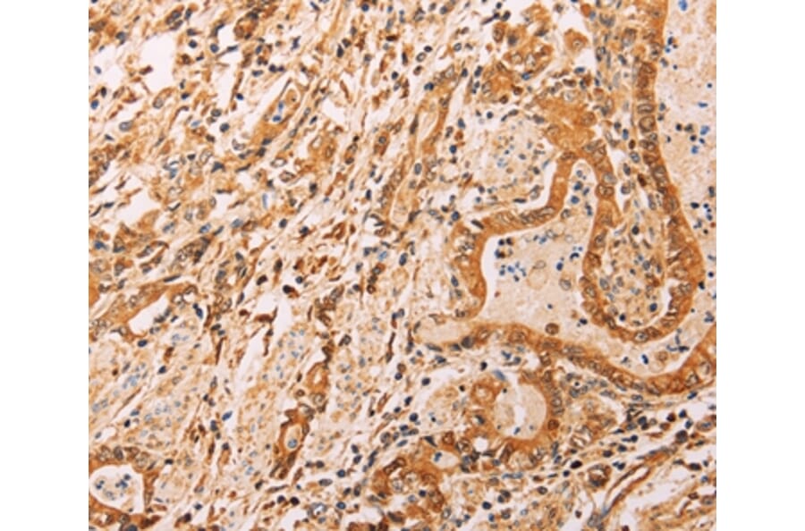 Immunohistochemistry - ADH1B Antibody from Signalway Antibody (37319) - Antibodies.com