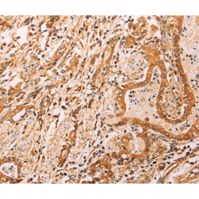 Immunohistochemistry - ADH1B Antibody from Signalway Antibody (37319) - Antibodies.com