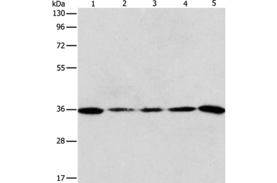 AURKC Antibody from Signalway Antibody (37365) - Antibodies.com